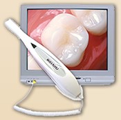 Intra Oral Dental Camera